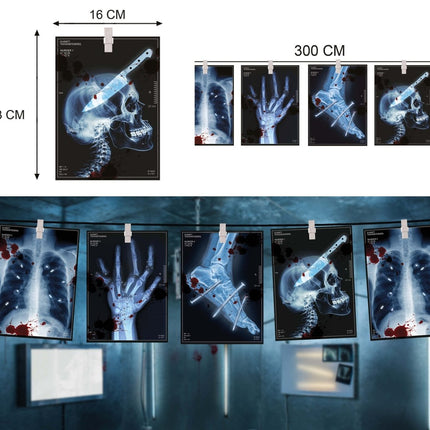Halloween Slinger Radiografisch 3m van Fiestas Guirca koop je bij Partywinkel